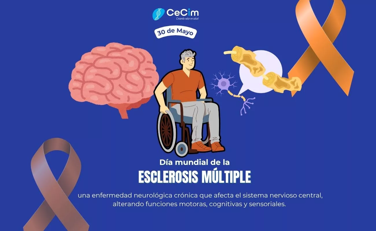 esclerosis múltiple
