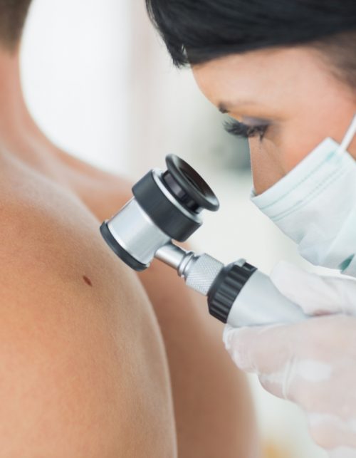 dermatologist-examining-mole-on-patient